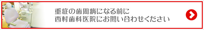 重症の歯周病になる前に西村歯科医院にお問い合わせください