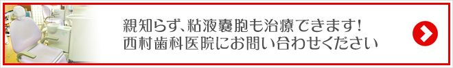 親知らず、粘液嚢胞も治療できます!
西村歯科医院にお問い合わせください